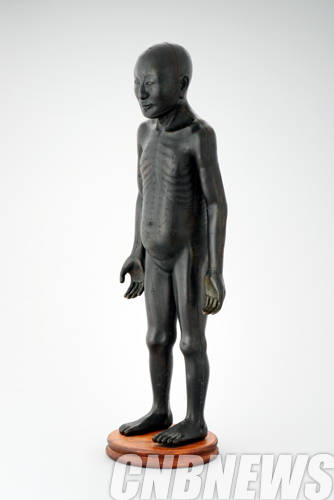 '경혈을 나타낸 동인'.(사진=문화재청)